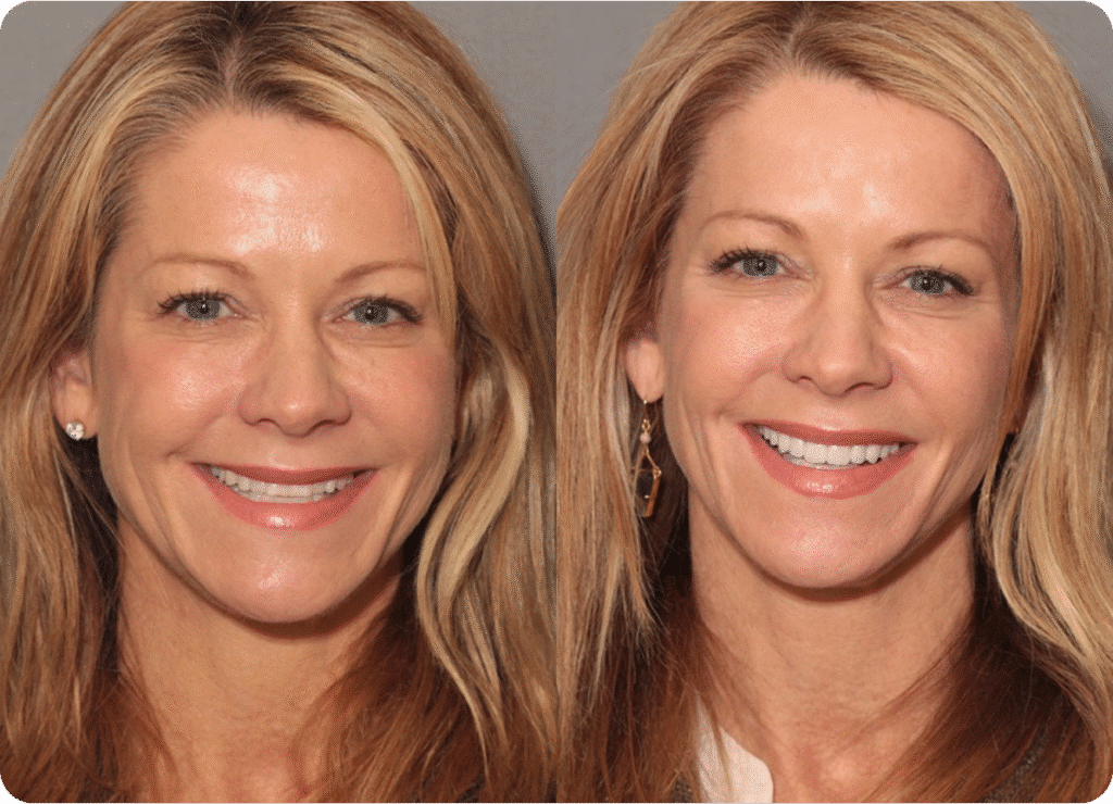 view-gallery@1.2x Home